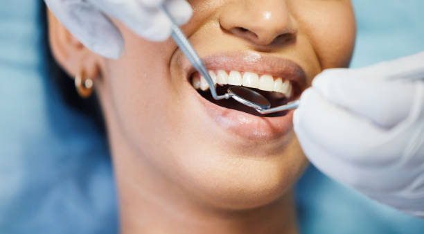 Best Cosmetic Emergency Dentistry in San Buenaventura, CA